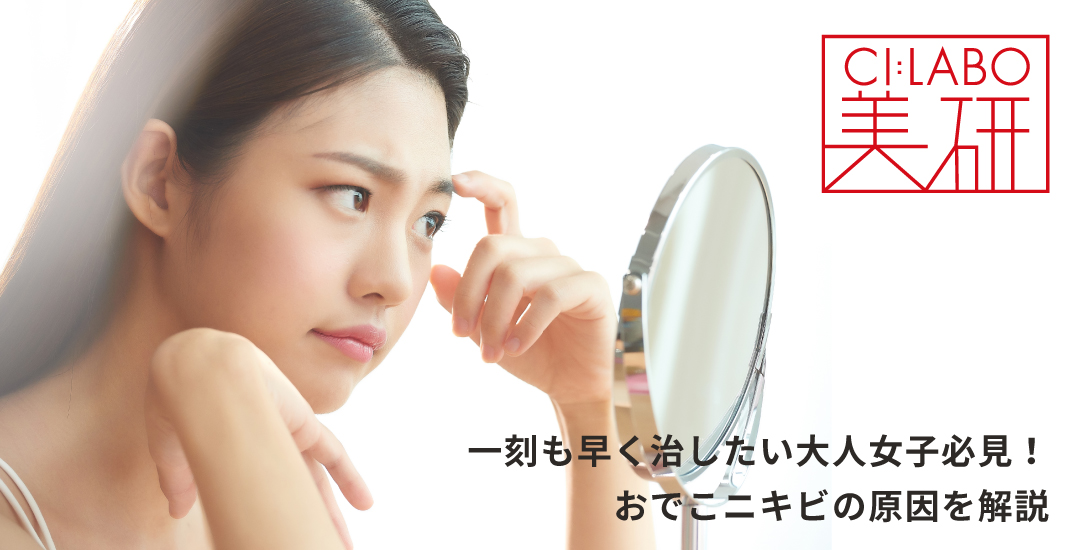 一刻も早く治したい大人女子必見！おでこニキビの原因を解説